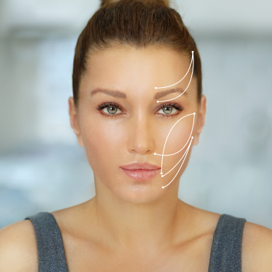 Fadenlifting Berlin - Frau nach ihrer Lifting Behandlung