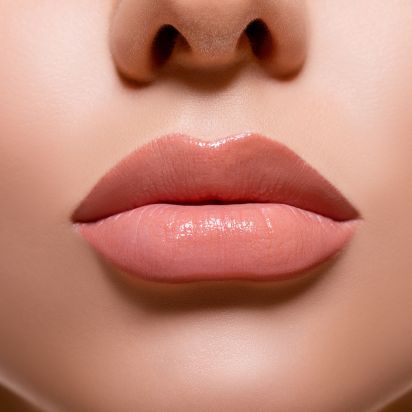 Lippenvergrößerung by Beautyberlin